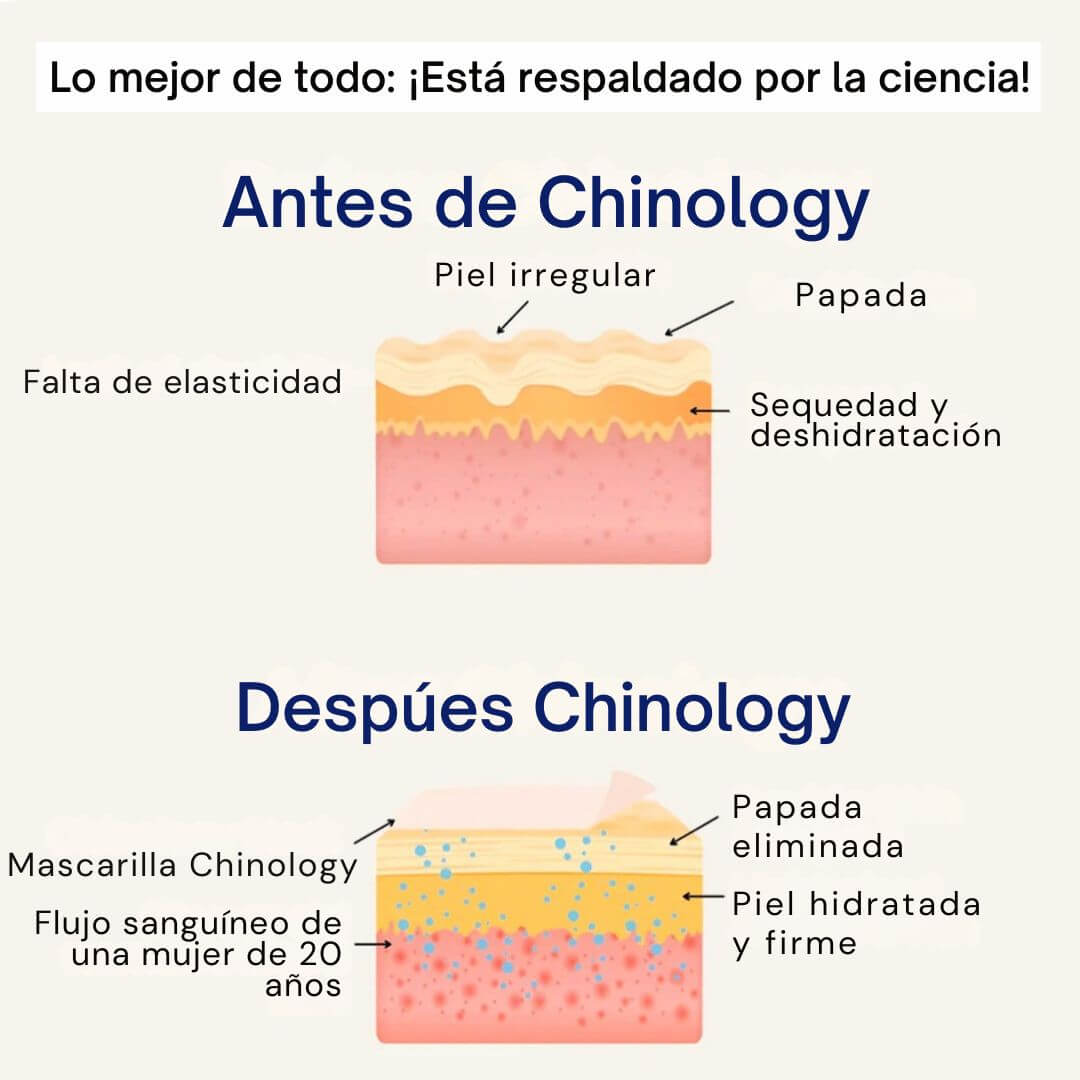 Chinology™ Lift - Elimina tu papada en 4 semanas
